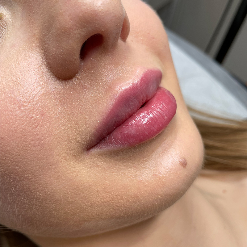 POWIĘKSZANIE I MODELOWANIE UST