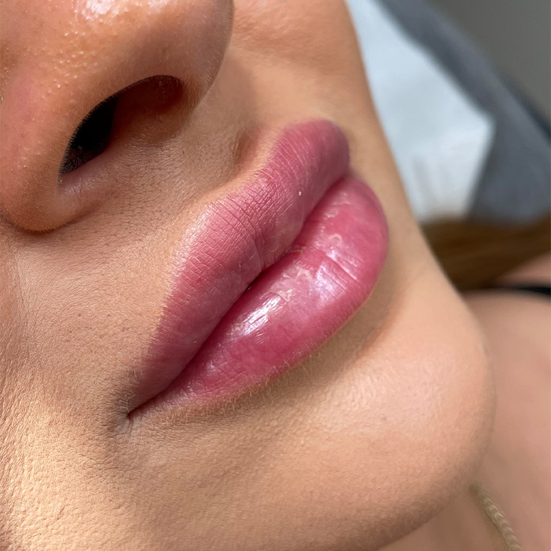 POWIĘKSZANIE I MODELOWANIE UST